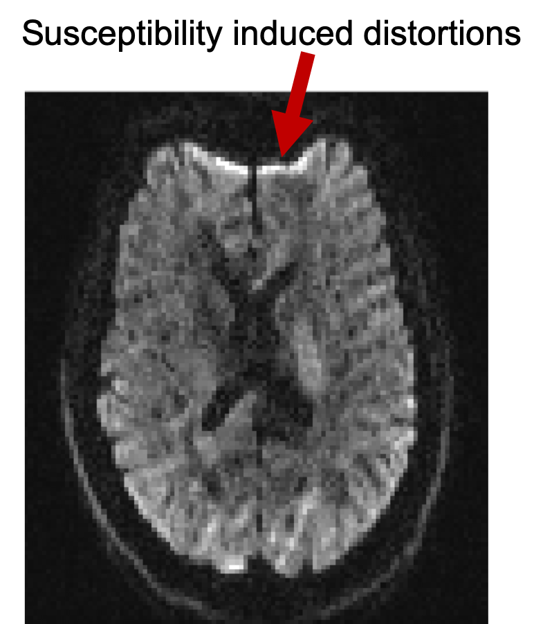 Susceptibilty induced distortions